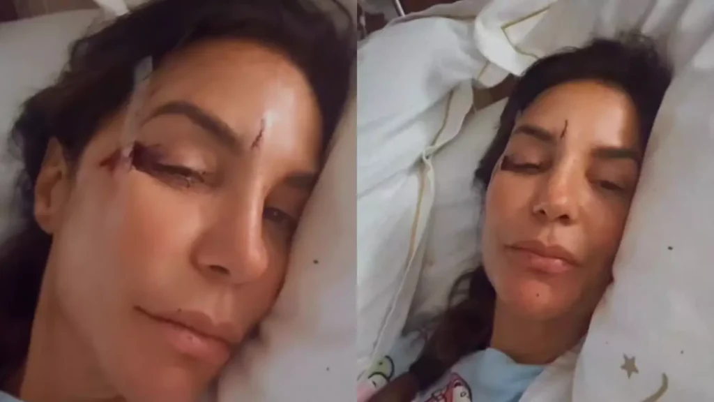 ivete-sangalo-e-internada-ao-sofrer-desmaio-e-bater-a-cabeca